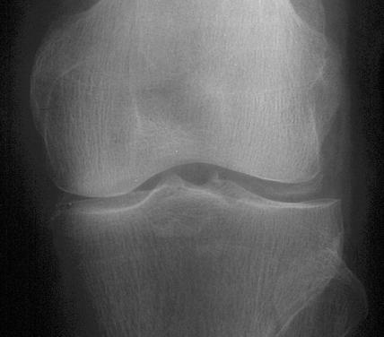 Copy of Rheumatology Module 4 - FRACPractice: MCQs for the FRACP ...